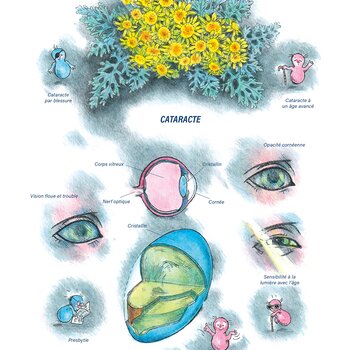 Tableaux médicaux Cineraria maritima. Cataracte.