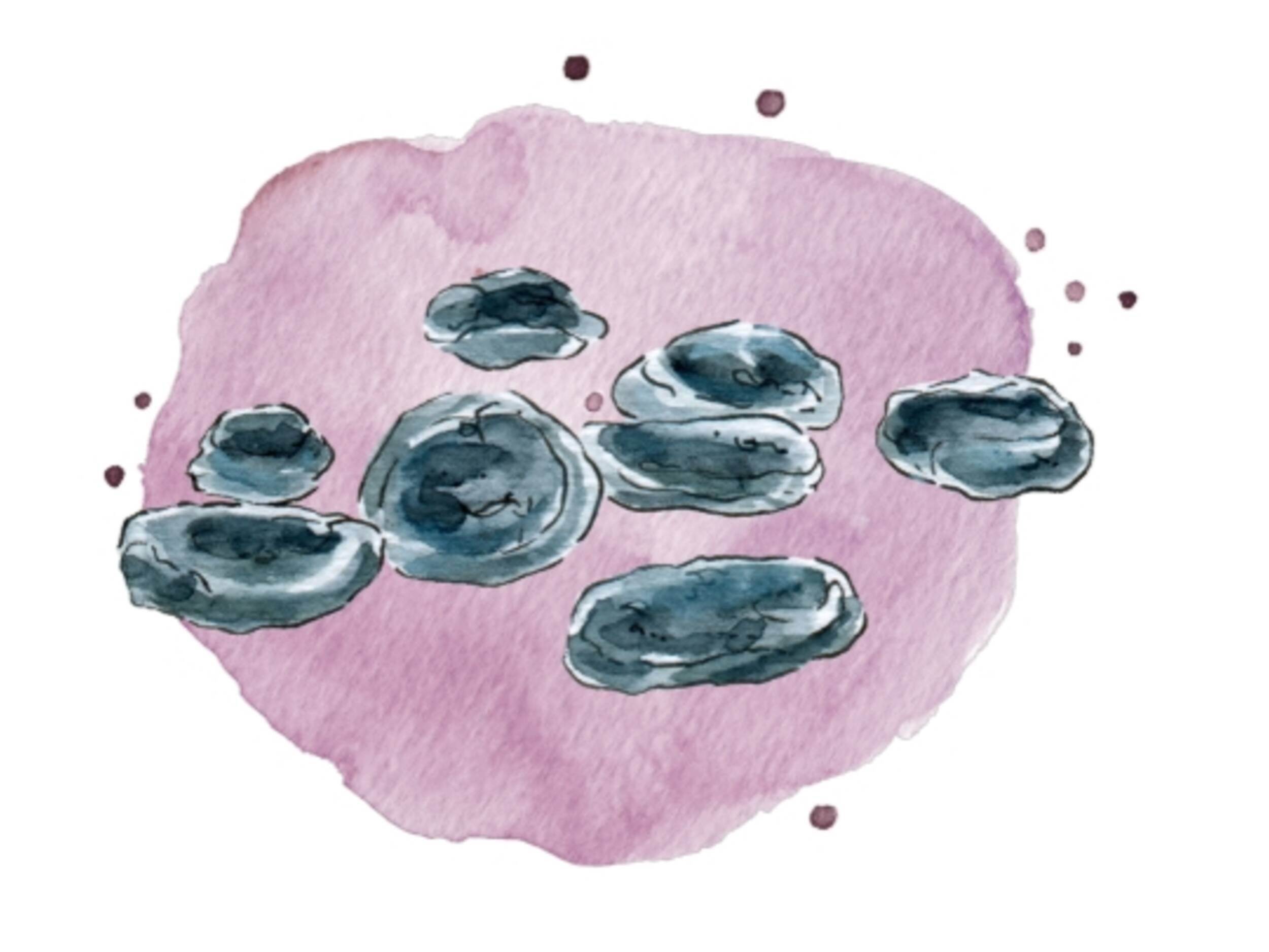 Metallisches Zink in der Homöopathie