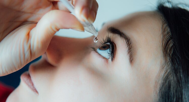 Frau tropft sich Augentropfen ins Auge | © iStock