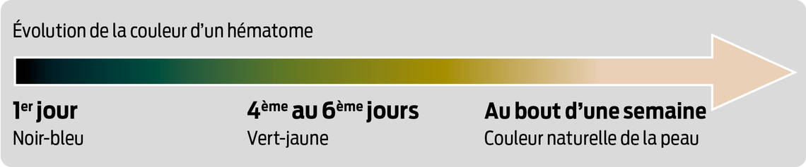 Évolution de la couleur d'un hématome
