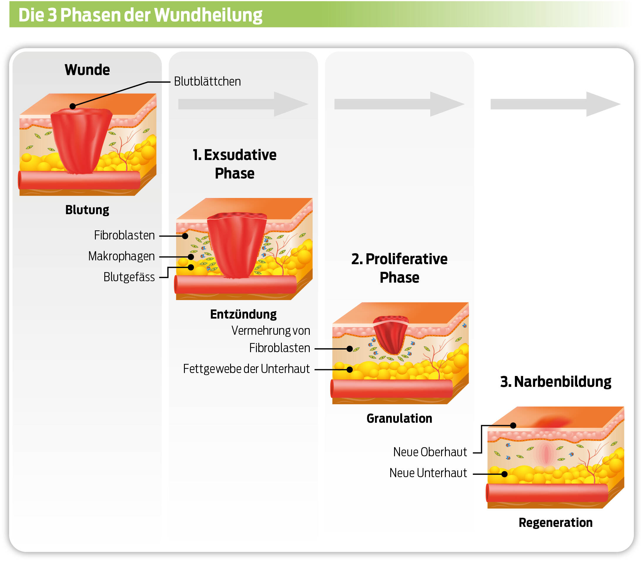 Wundheilung - Phasen und erste Hilfe